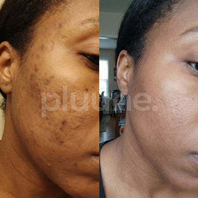 Month 2 progress