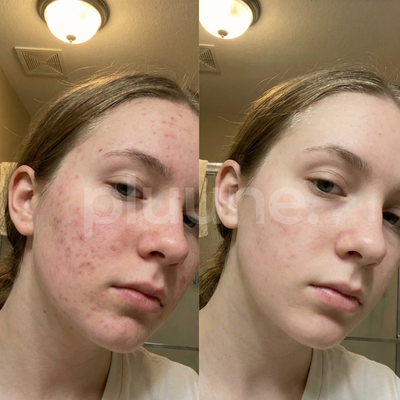 Week 1 progress