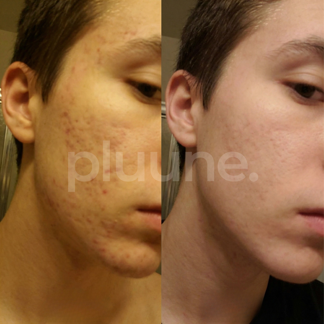 Before and after month 2