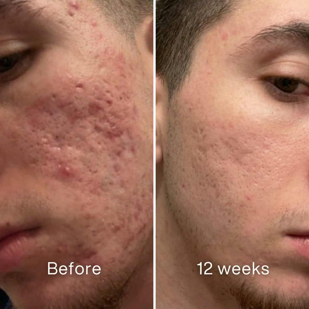Before and after 8 weeks